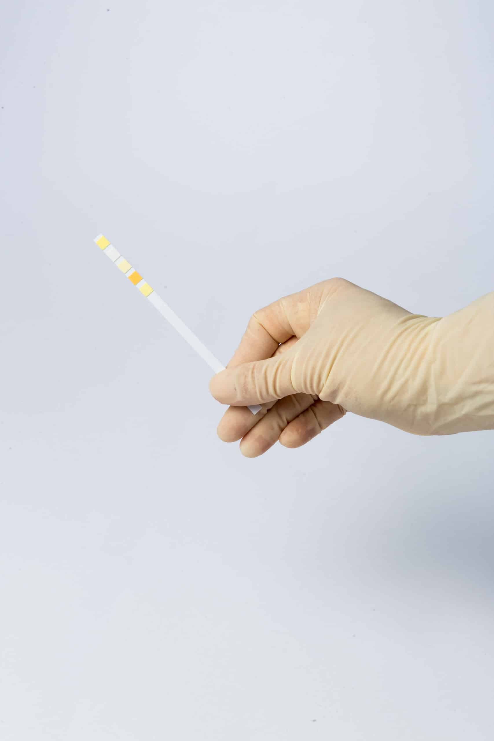 A gloved hand holds a single diagnostic test strip against a plain white background, showing no clinical context or product range.