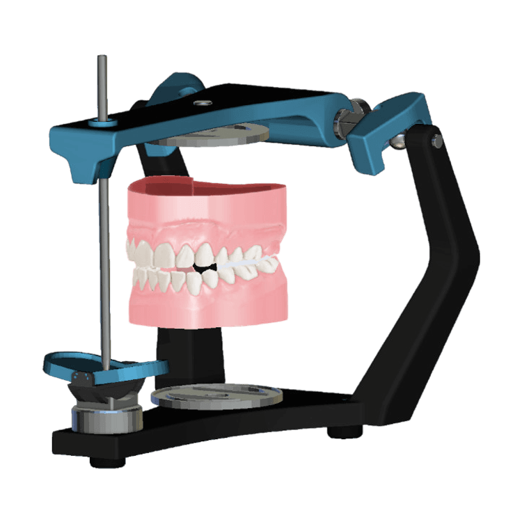 Bite - Occlusal Splint