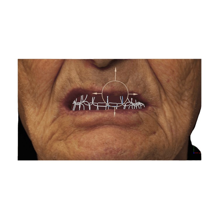 Smile Creator