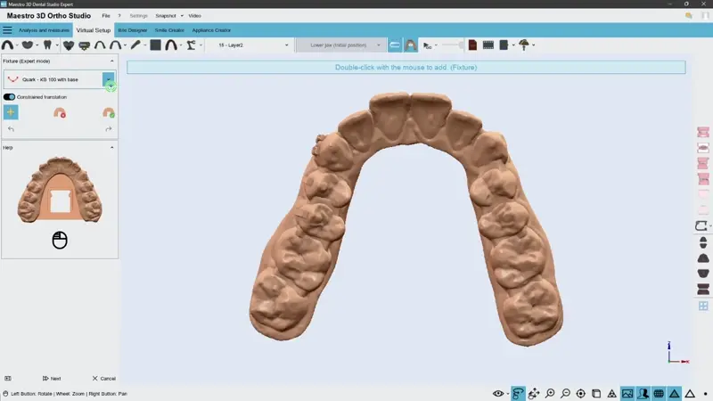 Maestro 3D Dental Studio interface showing the virtual setup module with automated aligner trimming and trim line detection tools.