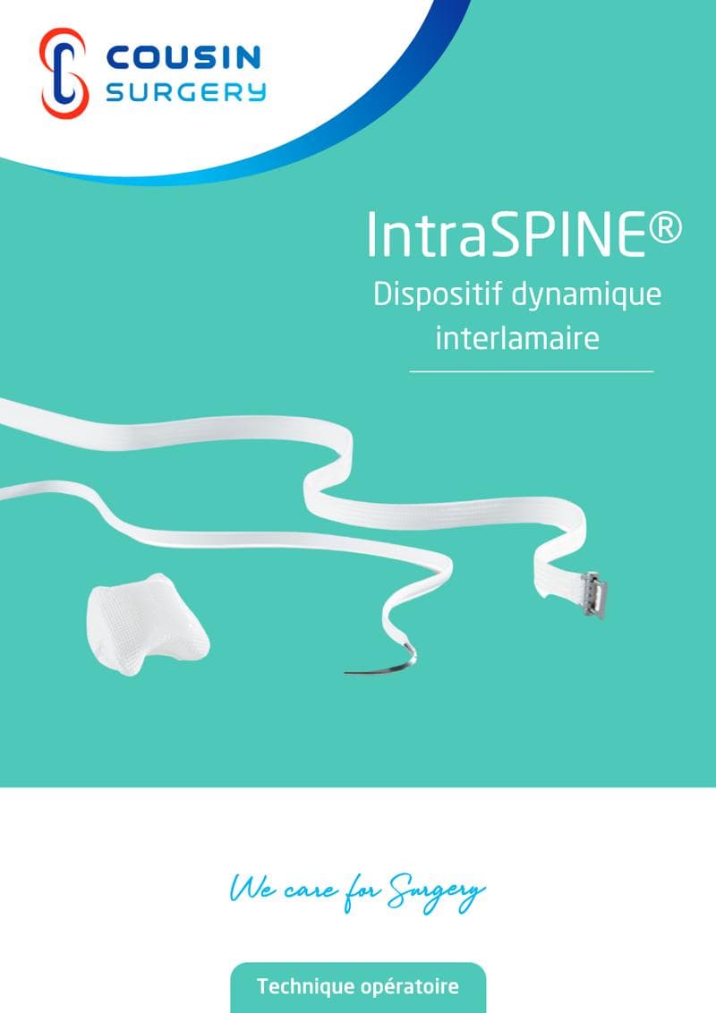 INTRASPINE Operator Manual