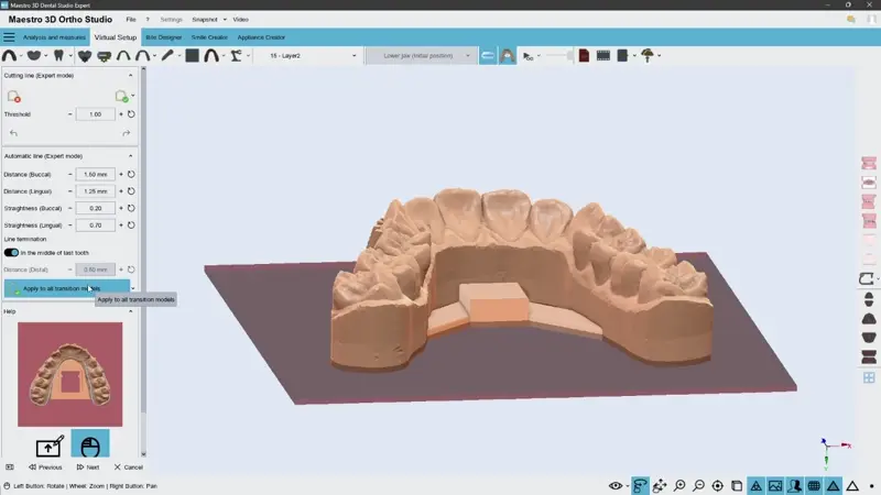 Maestro 3D Dental Studio interface displaying tools for automated aligner trimming and AI-driven cutting line generation parameters.