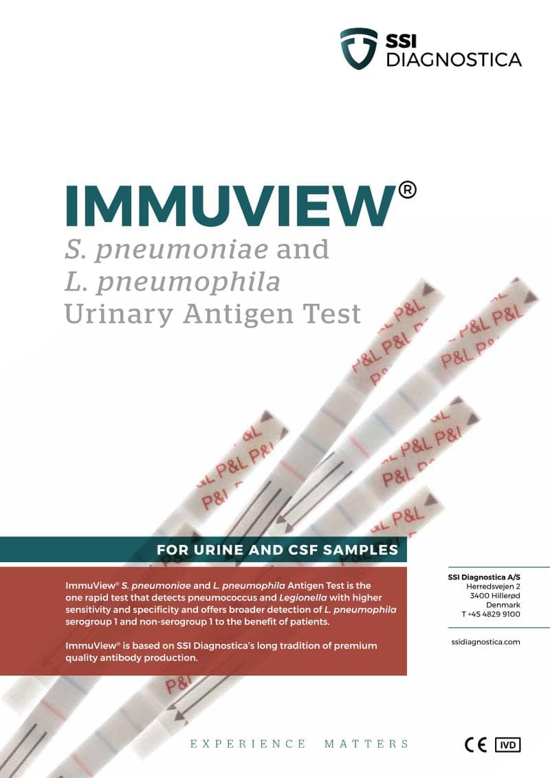 ImmuView Antigen Tests Spec Sheet