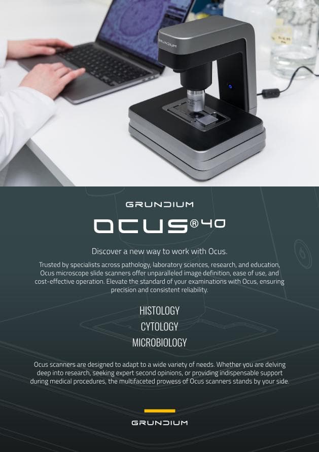 Grundium Ocus 40 Spec Sheet