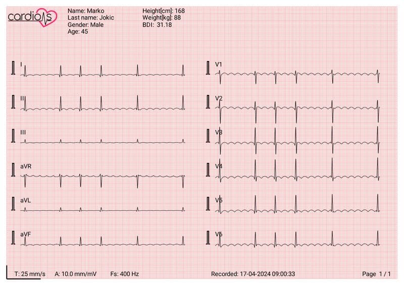 CardioNS ECG Device Document