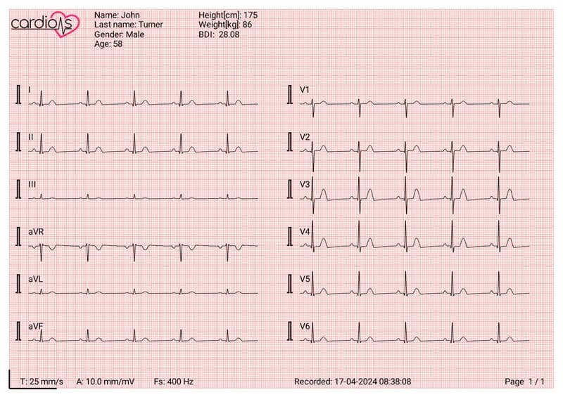 CardioNS ECG Device Document
