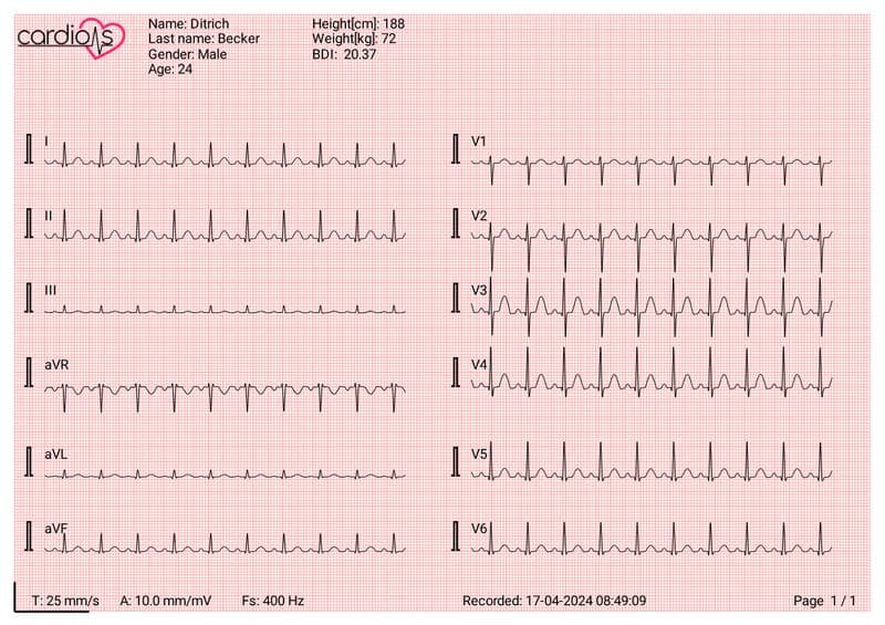 CardioNS ECG Device Document