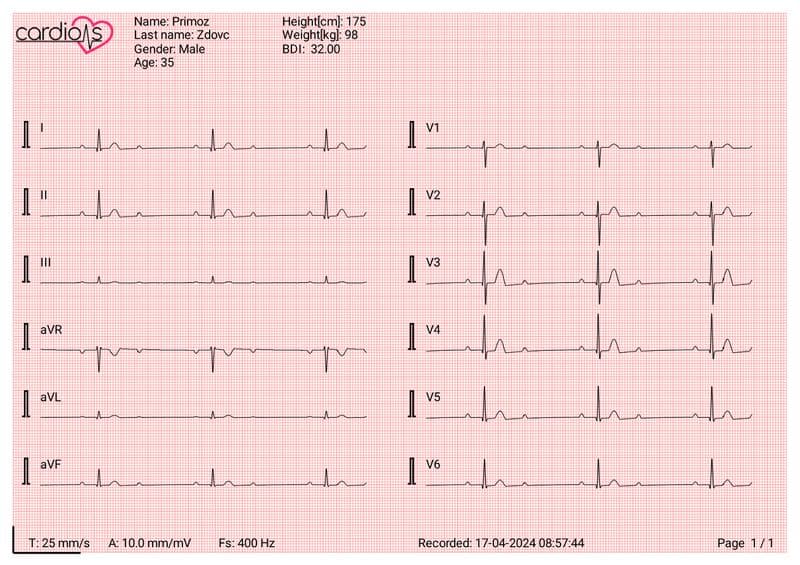 CardioNS ECG Device Document