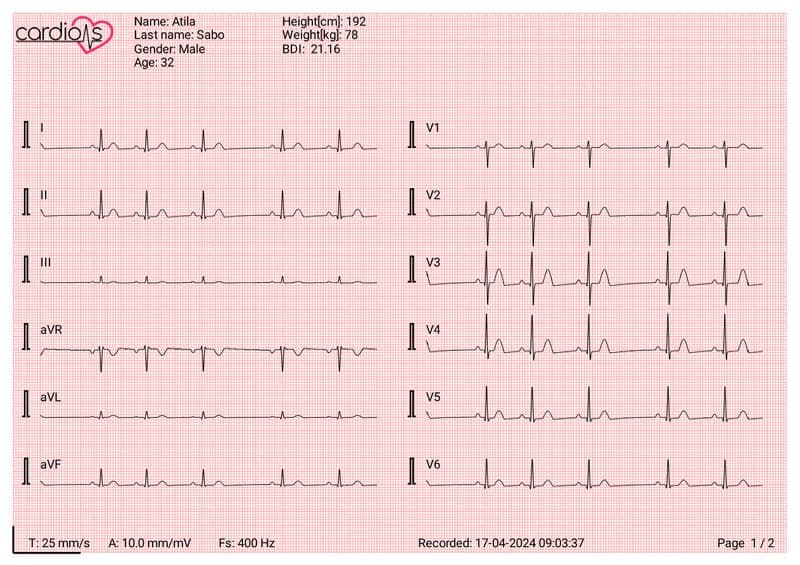 CardioNS ECG Device Document