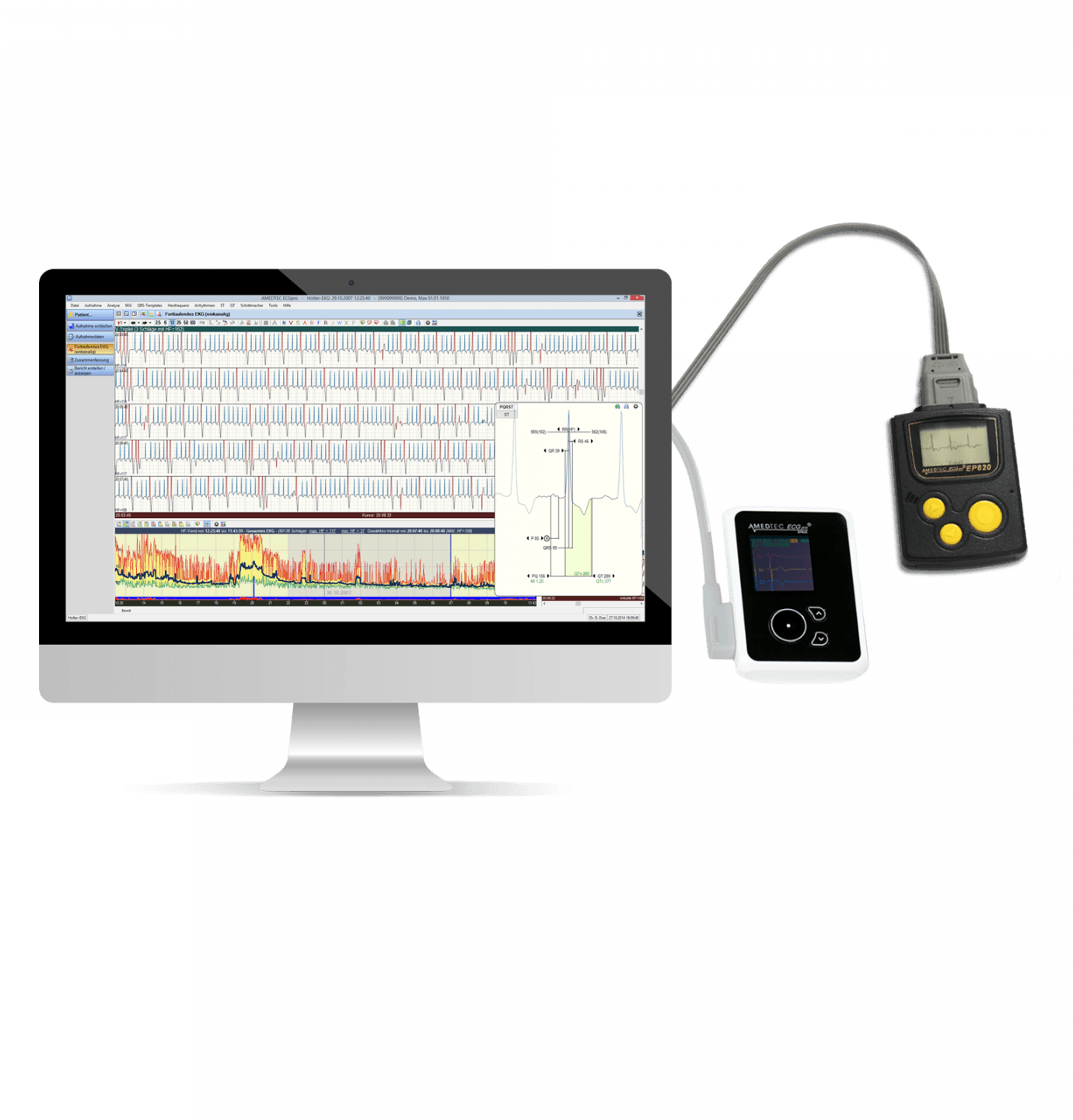 EP830 Holter Recorder