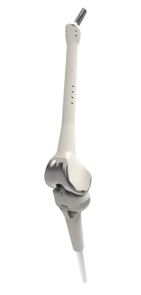 CMS Total Knee Replacement with Full Femur