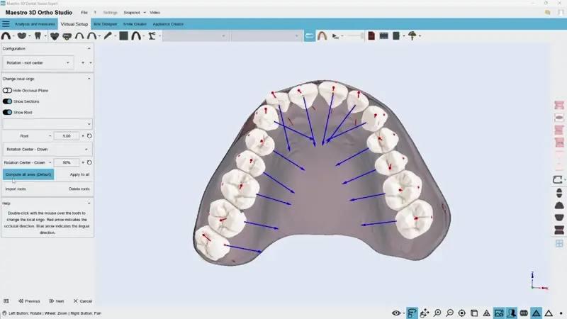 Advanced Integration of Scanned Crowns and CBCT Roots