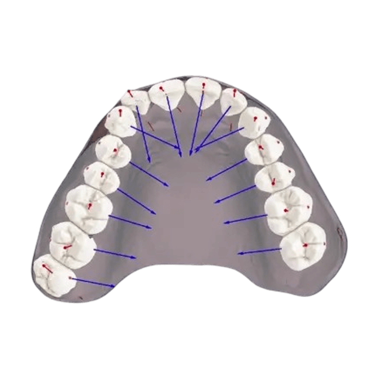 Advanced Integration of Scanned Crowns and CBCT Roots