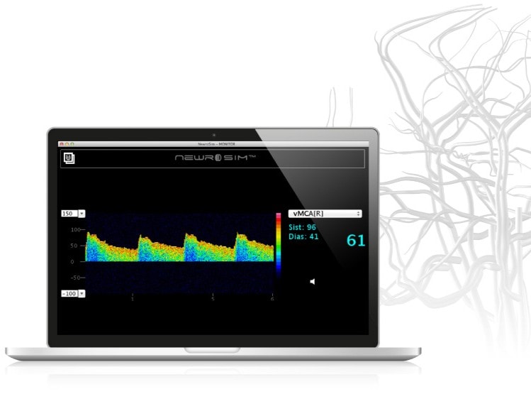 NewroSim: Neurological Virtual Simulator